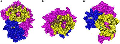 Reflections on HLA Epitope-Based Matching for Transplantation